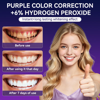 Teeth Whitening Dry Strips